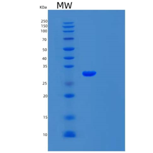 Recombinant Human Carbonic Anhydrase 7/CA7 Protein(C-6His),Recombinant Human Carbonic Anhydrase 7/CA7 Protein(C-6His)