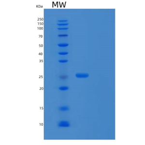 Recombinant Human Chymotrypsinogen B/CTRB1 Protein(C-6His)