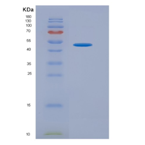 Eukaryotic High Mobility Group Protein 1 (HMGB1)