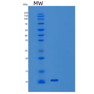 Recombinant Human WAP Four-Disulfide Core Domain Protein 2/WFDC2 Protein(C-6His)