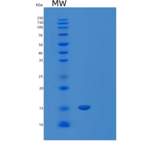 Recombinant Human LAIR-2/CD306 Protein(C-6His)