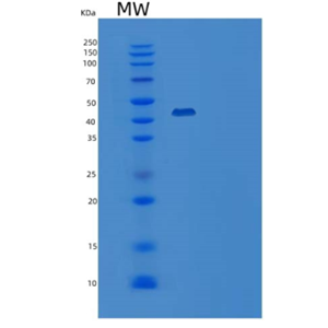 Recombinant Human CD147 / EMMPRIN / Basigin Protein (Fc tag),Recombinant Human CD147 / EMMPRIN / Basigin Protein (Fc tag)