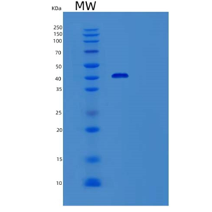 Recombinant Human Semenogelin-1/SEMG1 Protein(C-6His)