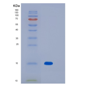 Recombinant Human Myelin Oligodendrocyte Glycoprotein/MOG Protein(C-6His)