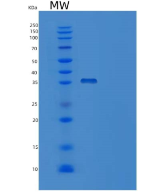 Recombinant Human NRG1-beta 1 Protein (EGF Domain, Fc tag),Recombinant Human NRG1-beta 1 Protein (EGF Domain, Fc tag)