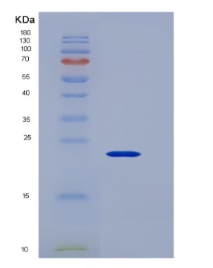 Recombinant Human CD147 / EMMPRIN / Basigin Protein (His tag),Recombinant Human CD147 / EMMPRIN / Basigin Protein (His tag)