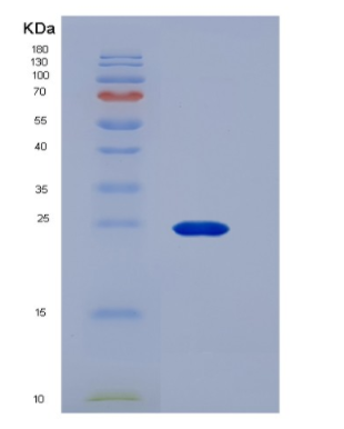 Recombinant Human CD16a / FCGR3A Protein (176 Phe, His & AVI tag),Recombinant Human CD16a / FCGR3A Protein (176 Phe, His & AVI tag)
