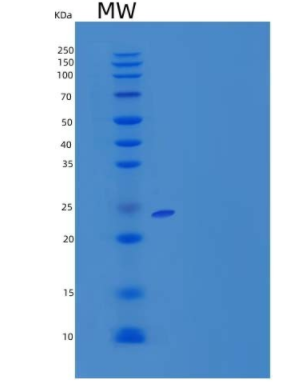 Recombinant Mouse HLA class II histocompatibility antigen gamma chain Protein,Recombinant Mouse HLA class II histocompatibility antigen gamma chain Protein