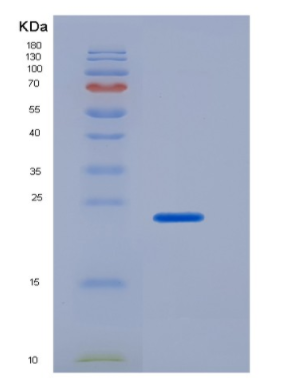 Recombinant Human CD16a / FCGR3A Protein (176 Phe, His tag),Recombinant Human CD16a / FCGR3A Protein (176 Phe, His tag)