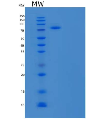 Recombinant Human Annexin A6/ANXA6 Protein(C-6His),Recombinant Human Annexin A6/ANXA6 Protein(C-6His)