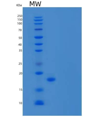 Recombinant Human Anterior Gradient Protein 3 Homolog/AG-3/BCMP11/AGR3 Protein(C-6His),Recombinant Human Anterior Gradient Protein 3 Homolog/AG-3/BCMP11/AGR3 Protein(C-6His)