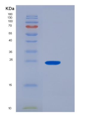 Recombinant Human CD16a / FCGR3A Protein (176 Val, His & AVI tag), Biotinylated,Recombinant Human CD16a / FCGR3A Protein (176 Val, His & AVI tag), Biotinylated