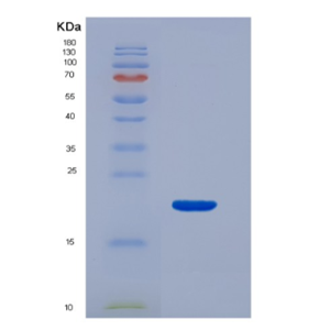 Eukaryotic Interferon Gamma (IFNg).