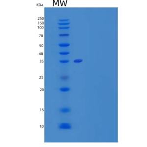 Recombinant Mouse Follistatin-Like 1/FSTL1 Protein(C-6His)