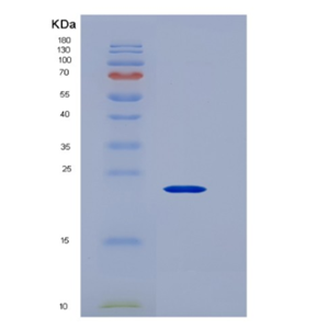 Recombinant Human CD147 / EMMPRIN / Basigin Protein (His tag)