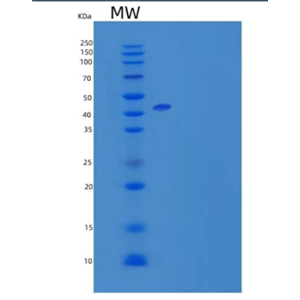 Recombinant Mouse Leukocyte Mono Ig-Like Receptor 1/LMIR1/CD300a Protein(C-Fc)