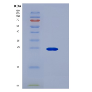 Recombinant Human CD16a / FCGR3A Protein (176 Phe, His & AVI tag)