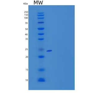 Recombinant Mouse HLA class II histocompatibility antigen gamma chain Protein