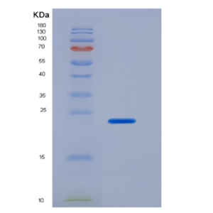 Recombinant Human CD16a / FCGR3A Protein (176 Phe, His tag)