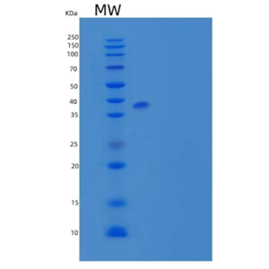 Recombinant Mouse Activin Receptor IB/Activin RIB/ALK-4/ACVR1B Protein(C-Fc)