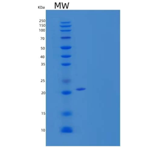 Recombinant Human Neuroplastin/NPTN Protein(C-6His),Recombinant Human Neuroplastin/NPTN Protein(C-6His)