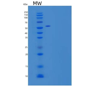 Recombinant Human Clusterin/ApoJ Protein(C-6His)