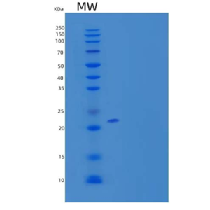 Recombinant Human OX-2/MOX1/CD200 Protein(C-6His)