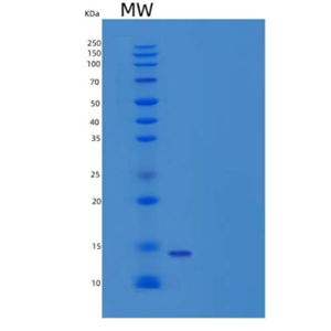 Recombinant Human Cystatin M/CST6 Protein(C-6His)