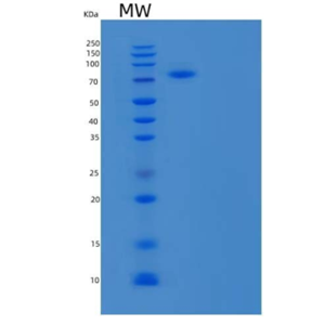 Recombinant Human Annexin A6/ANXA6 Protein(C-6His),Recombinant Human Annexin A6/ANXA6 Protein(C-6His)