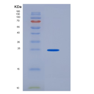 Recombinant Human CD16a / FCGR3A Protein (176 Val, His & AVI tag),Recombinant Human CD16a / FCGR3A Protein (176 Val, His & AVI tag)