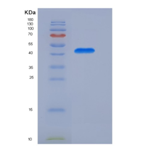 Eukaryotic Cluster Of Differentiation 8b (CD8b)