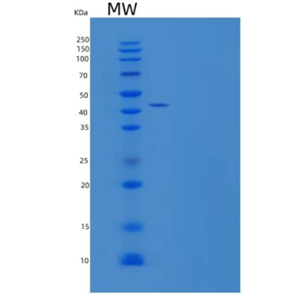 Recombinant Human PRV1/CD177 Protein(C-6His),Recombinant Human PRV1/CD177 Protein(C-6His)