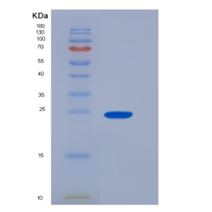 Recombinant Human CD16a / FCGR3A Protein (176 Val, His & AVI tag), Biotinylated