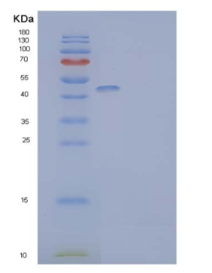 Recombinant Human Death Receptor 3/DR3/TNFRSF25 Protein(C-Fc),Recombinant Human Death Receptor 3/DR3/TNFRSF25 Protein(C-Fc)