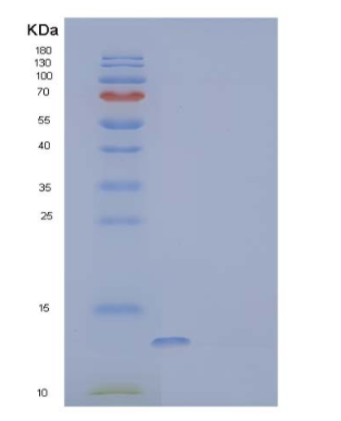 Recombinant Human Secreted and Transmembrane Protein 1 Protein,Recombinant Human Secreted and Transmembrane Protein 1 Protein