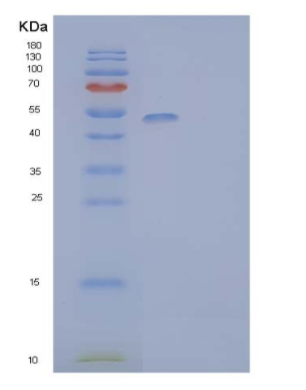 Recombinant Mouse Natural Cytotoxicity Triggering Receptor 1/NCR1Protein (C-6His),Recombinant Mouse Natural Cytotoxicity Triggering Receptor 1/NCR1Protein (C-6His)