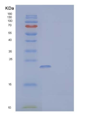 Recombinant Mouse NKG2D Ligand 1/NKG2DL/ULBP1 Protein(C-6His),Recombinant Mouse NKG2D Ligand 1/NKG2DL/ULBP1 Protein(C-6His)