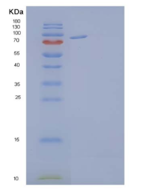 Recombinant Human Ephrin A Receptor 4/EphA4 Protein(C-Fc),Recombinant Human Ephrin A Receptor 4/EphA4 Protein(C-Fc)