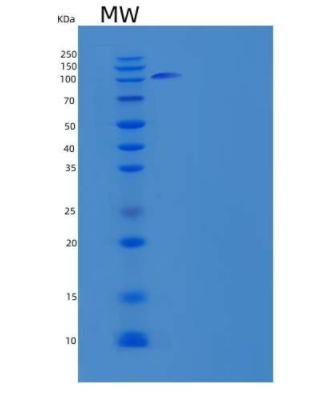 Recombinant Human Semaphorin-4D/SEMA4D/CD100 Protein(C-Fc),Recombinant Human Semaphorin-4D/SEMA4D/CD100 Protein(C-Fc)