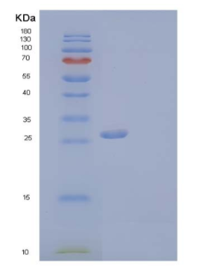 Recombinant Human Collectin-11/COLEC11 Protein(C-6His),Recombinant Human Collectin-11/COLEC11 Protein(C-6His)