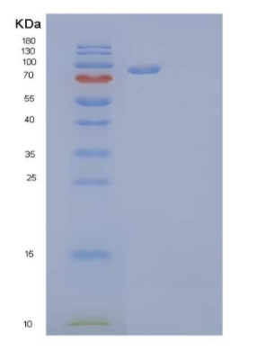 Recombinant Human Oncostatin-M-Specific Receptor Subunit β/OSMRB/IL-31RB Protein(C-6His),Recombinant Human Oncostatin-M-Specific Receptor Subunit β/OSMRB/IL-31RB Protein(C-6His)