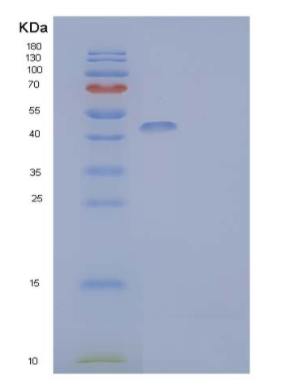 Recombinant Mouse HLADG/CD74 Protein(C-mFc-6His),Recombinant Mouse HLADG/CD74 Protein(C-mFc-6His)