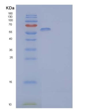 Recombinant Human IL-1 Receptor-Like 2/IL-1RL2 Protein(C-Fc),Recombinant Human IL-1 Receptor-Like 2/IL-1RL2 Protein(C-Fc)