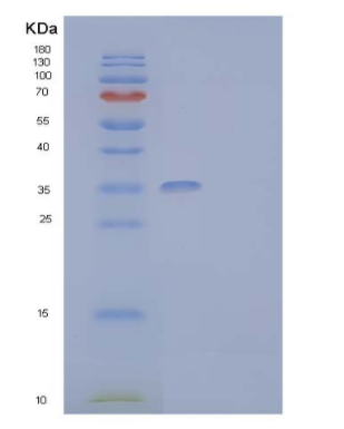 Recombinant Human Granulocyte-Macrophage Colony-Stimulating Factor Receptor Subunit alhpa Protein,Recombinant Human Granulocyte-Macrophage Colony-Stimulating Factor Receptor Subunit alhpa Protein