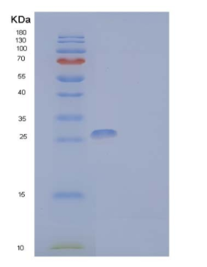 Recombinant Human IL-2 Receptor Subunit γ/IL-2RG/CD132 Protein(C-Fc-6His),Recombinant Human IL-2 Receptor Subunit γ/IL-2RG/CD132 Protein(C-Fc-6His)