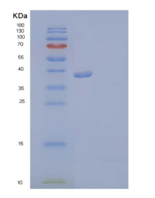 Recombinant Human Fibroblast Growth Factor Receptor 3 Protein,Recombinant Human Fibroblast Growth Factor Receptor 3 Protein