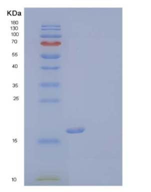 Recombinant Human Triggering Receptor Expressed On Myeloid 2/TREM-2 Protein(C-6His),Recombinant Human Triggering Receptor Expressed On Myeloid 2/TREM-2 Protein(C-6His)