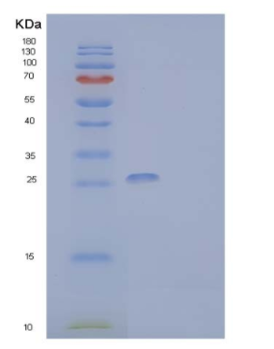 Recombinant Human CMRF35-Like Molecule 9 Protein,Recombinant Human CMRF35-Like Molecule 9 Protein