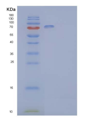 Recombinant Human Ephrin type-B receptor 2 Protein,Recombinant Human Ephrin type-B receptor 2 Protein