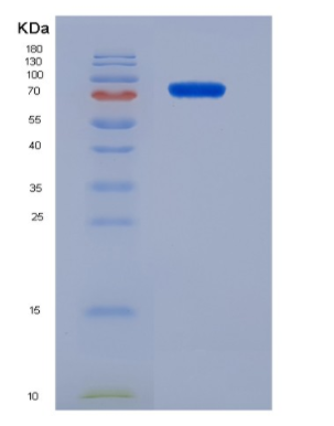 Eukaryotic Vascular Endothelial Growth Factor Receptor 2 (VEGFR2),Eukaryotic Vascular Endothelial Growth Factor Receptor 2 (VEGFR2)